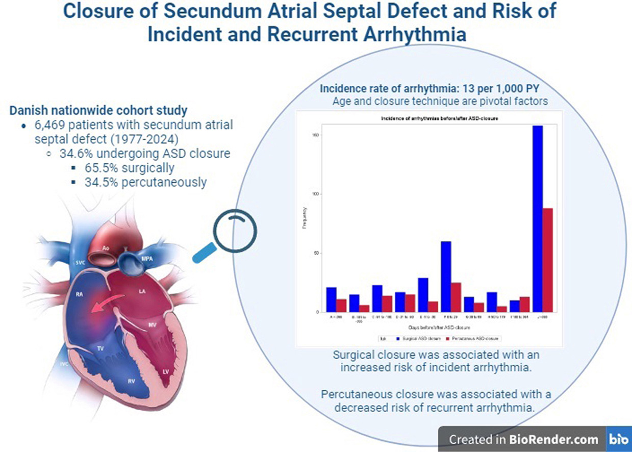 心房中隔欠損症治療後の不整脈について